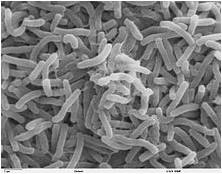 La cara de la muerte: fotografía tomada mediante microscopio electrónico del Vibrio Colerae, bacteria que causa el Cólera. (Fuente: wikipedia).